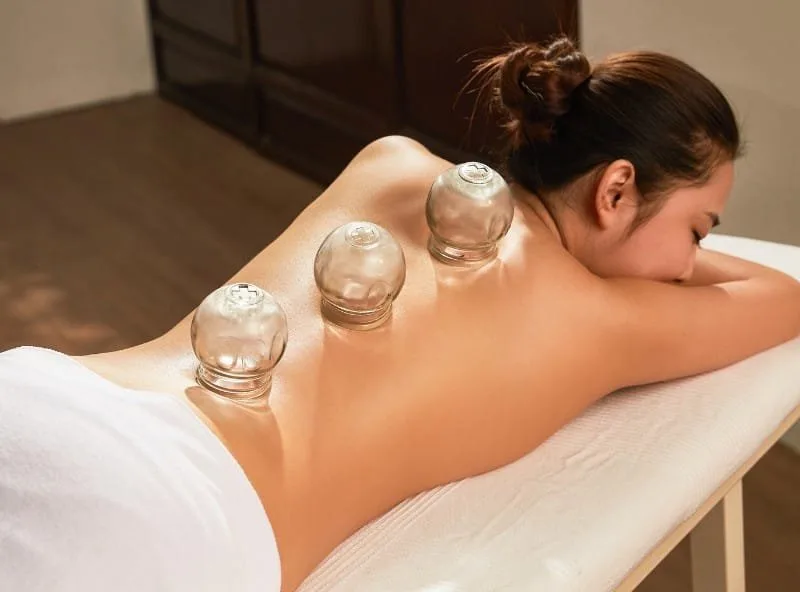 Cupping Therapy in Surrey: Ancient Healing for Today’s Pain Relief