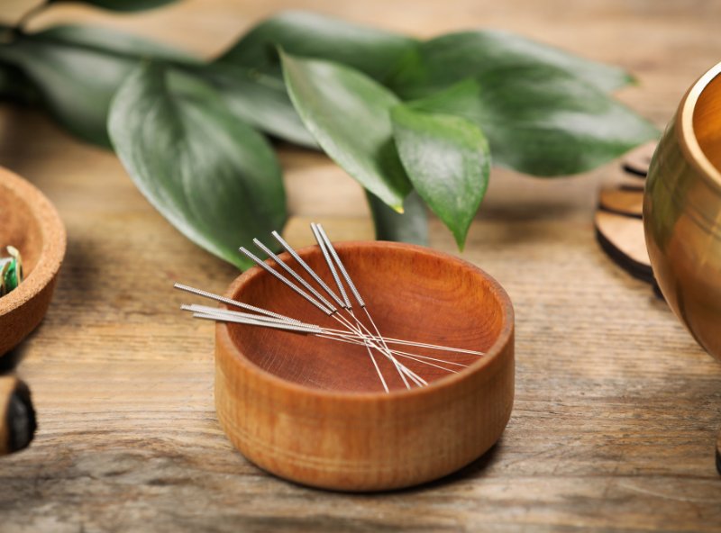 Acupuncture Services