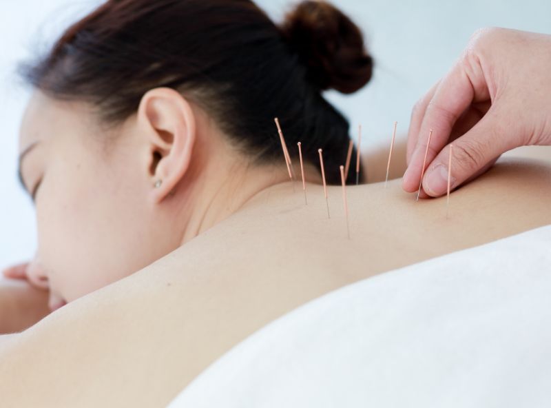 Expert Acupuncture Services